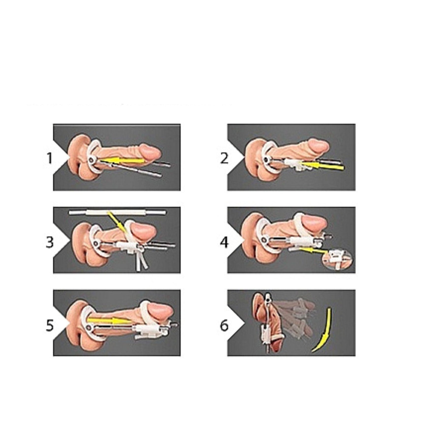 Extensor de penis pompat alb