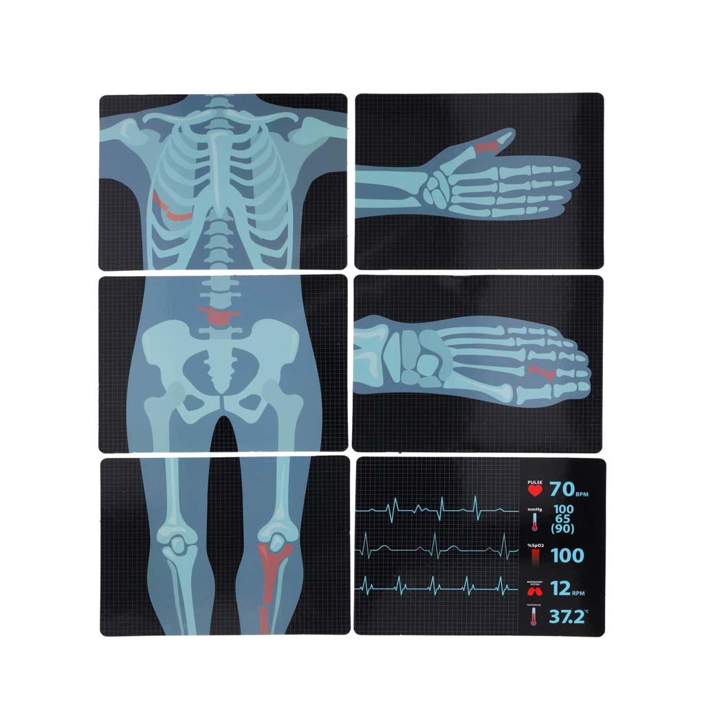 Set mare de doctor stație medicală doctor mic ekg radiografie lumină sunet